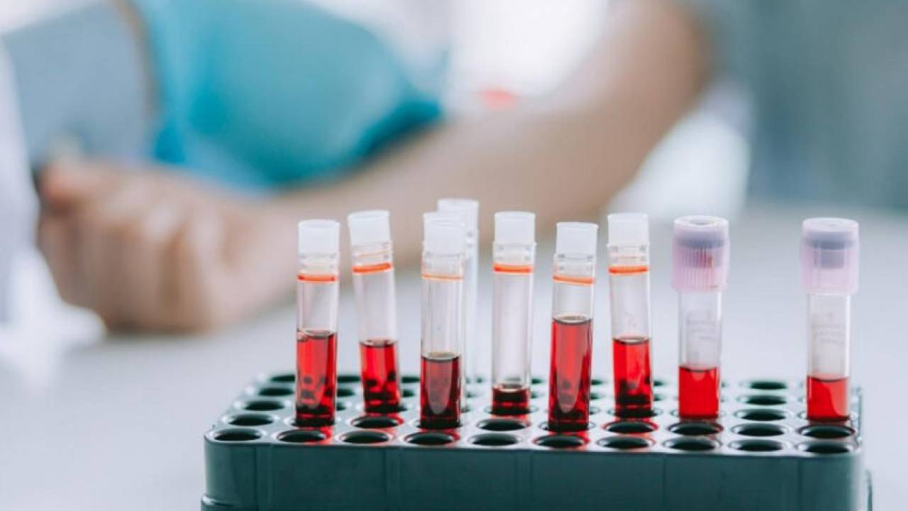 Badania krwi w kierunku choroby Alzheimera: osiągnięcia zmieniające podejście do leczenia tej choroby.