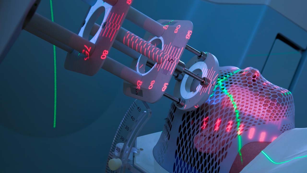 To, co wydaje nam się, że wiemy (i czym jest radioterapia): większa precyzja i lepsza tolerancja.